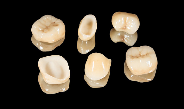 Six different types of dental crowns, all of different sizes and shapes