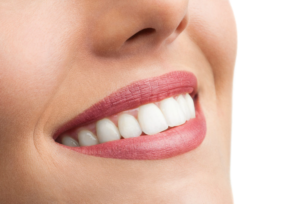 Can Veneers Whiten Teeth? See What a Cosmetic Dentist Says